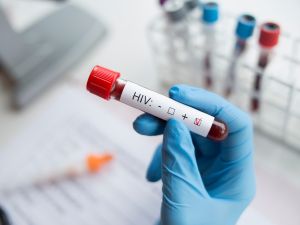 HIV+ kills Egyptian drug addicted dancer 