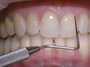 الطبيب كان يدير عيادة أسنان من قبو منزل