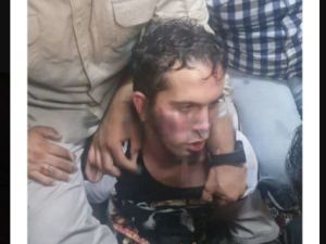 المشتبه به في الهجوم على المرقد لحظة اعتقاله