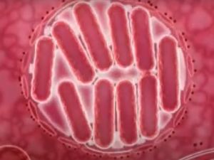 ارتفاع حصيلة عدوى الفيلقية في بولندا الى 11 وفاة و144 اصابة 