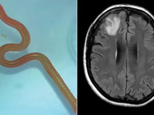 From(www.cdc.gov) Brain