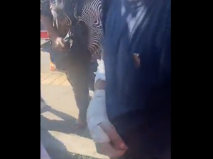 ضرب شاب كويتي بالساطور في تركيا