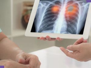 افضل دكاترة صدرية في الرياض