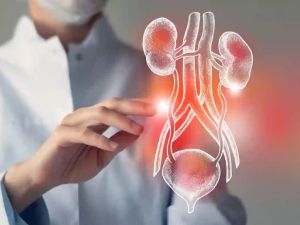 افضل دكاترة مسالك بولية في الرياض