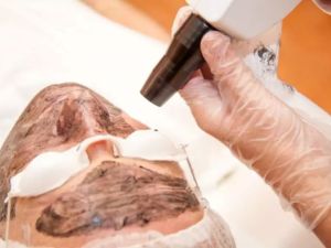 عيادات ليزر بالرياض