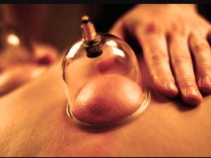 مراكز الحجامة في الرياض