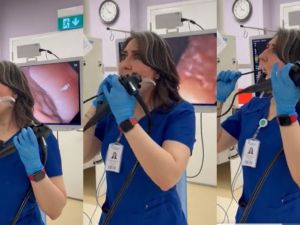 طبيبة تجري تنظير لنفسها