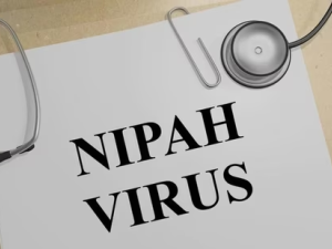 Nipah virus