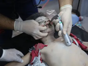 طفلة من بين مئات الضحايا الاطفال بالقصف الاسرائيلي