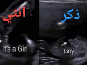 علامات نوع الجنين في الشهر الخامس