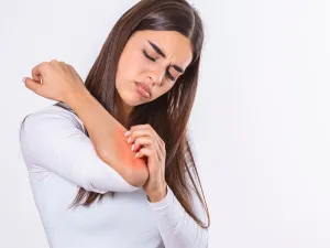 طبيب البوابة: أسباب حكة الجلد في الشتاء وطرق علاجها