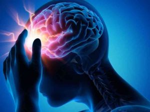 أفضل دكتور مخ وأعصاب في جدة