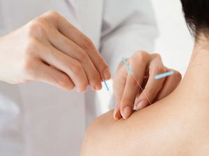 أفضل مركز للعلاج بالابر الصينية في دبي: 7 مراكز رائعة ننصحك بها
