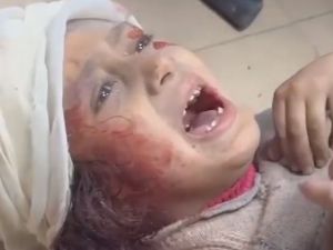 طفلة فلسطينية اصيبت خلال الجريمة الاسرائيلية في غزة