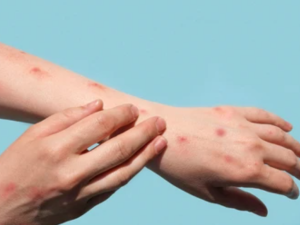 Shutterstock  virus