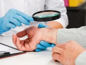 أفضل دكتور جلدية في دبي: 7 أطباء ننصحك بهم مع العناوين