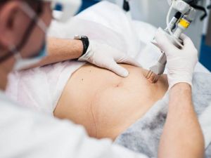 أفضل 9 عيادات شفط الدهون في دبي ننصحك بها