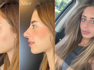 ميا شيم (قبل وبعد)