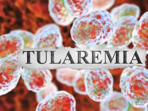 Tularemia disease
