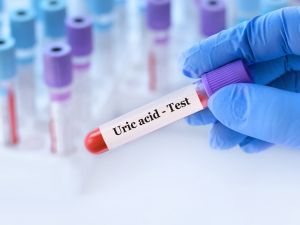 طرق بسيطة لتقليل حمض اليوريك في الجسم