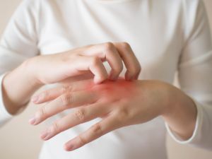 skin allergies
