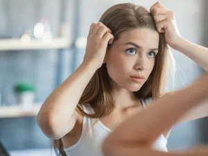 طبيب البوابة: هل استخدام زيت الشعر يزيد من القشرة ؟