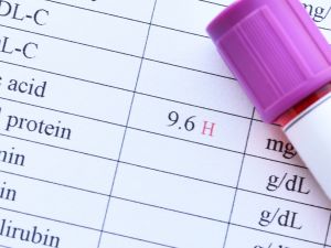 5 علاجات طبيعية لخفض مستويات حمض البوليك