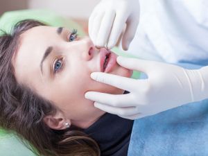 عملية رفع الشفة العلوية LIP LIFTING وتأثيرها على الأعصاب