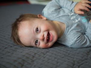Down Syndrome baby