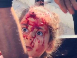 UN urges immediate action to stop Israeli genocide in Gaza 