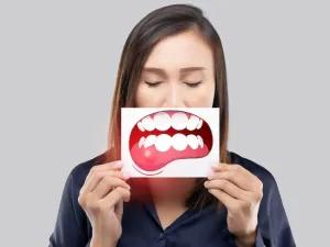 أفضل وصفة لعلاج التهاب اللثة في المنزل