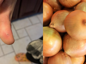 Onion