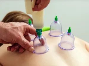 مواعيد الحجامة النبوية لشهر أيار/ ذو القعدة