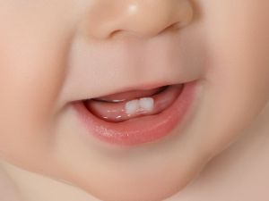كيف تحافظين على أسنان طفلك منذ ظهورها الأولى؟