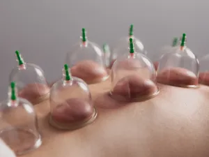 أفضل وقت لعمل حجامة في شهر نوفمبر 2025