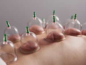 أفضل وقت لعمل حجامة في شهر نوفمبر 2025