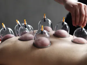 أفضل أيام الحجامة لشهر حزيران/يونيو 2026