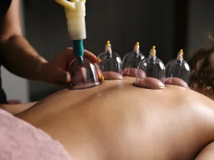 أشياء يجب تذكرها عند إجراء الحجامة