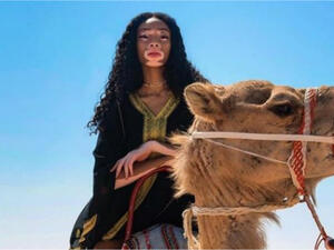 Harlow shot to fame on America’s Next Top Model in 2014 and has since worked with the who’s who of the fashion industry’s elite, including Marc Jacobs and Tommy Hilfiger. (Source: winnieharlow - Instagram)