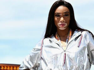 Winne Harlow shared the magazine cover on Instagram. (Source: AFP)