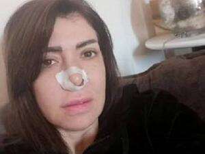 لقاء سويدان تخضع للجراجة: تجميل أم جيوب أنفية؟