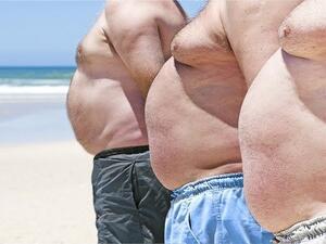 ازالة الكرش