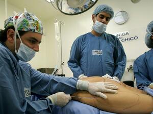 Liposuction remains the second most popular surgical procedure after breast augmentation (AFP/File Photo)	