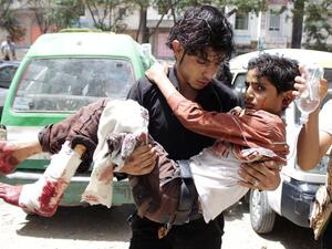 A man carries an injured child from fighting in Taiz (Source: AFP)