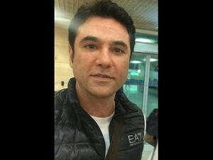 Ezz's face looked visibly smoother, especially around the mouth area. (Image: El Fagr news)