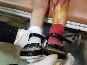  الضربات الجوية مستمرة على المناطق الخاضعة لسيطرة تنظيم الدولة الإسلامية 