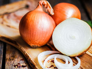 يستخدم البصل لعلاج تساقط الشعر وقشرة الرأس (shutterstock.com)