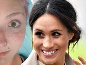 Meghan Markle fan copies royal’s famous freckles  (Twitter)