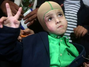 Five-year-old Ahmed Dawabsha, a Palestinian boy who survived a firebombing by Jewish extremists, in the northern West Bank city of Nablus on March 15, 2016. (AFP/File) 