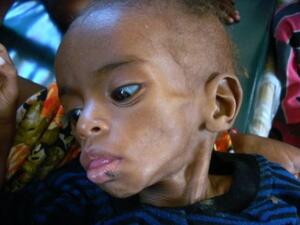 آلاف قد يموتون جراء الجفاف في الصومال 